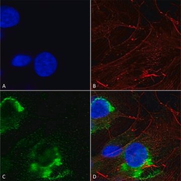 Monoclonal Anti-Lrrk2/Dardarin - Apc antibody produced in mouse clone S231B-34, purified immunoglobulin