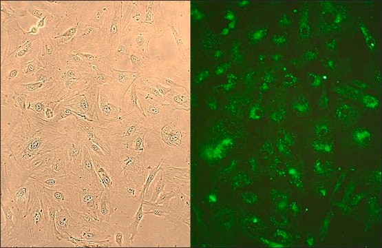 Human Lung Fibroblasts: HLF, adult