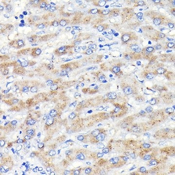 Anti-Glucosylceramidase beta (GBA) antibody produced in rabbit