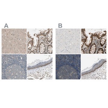 Anti-MST1R antibody produced in rabbit Ab1, Prestige Antibodies&#174; Powered by Atlas Antibodies, affinity isolated antibody, buffered aqueous glycerol solution