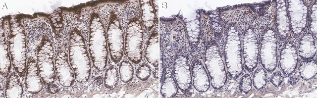 Anti-GalNAc-T5 Antibody, clone 5F11