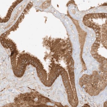 Anti-XRN1 antibody produced in rabbit Prestige Antibodies&#174; Powered by Atlas Antibodies, affinity isolated antibody, buffered aqueous glycerol solution