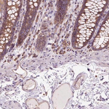 Anti-CISD3 antibody produced in rabbit Prestige Antibodies&#174; Powered by Atlas Antibodies, affinity isolated antibody, buffered aqueous glycerol solution