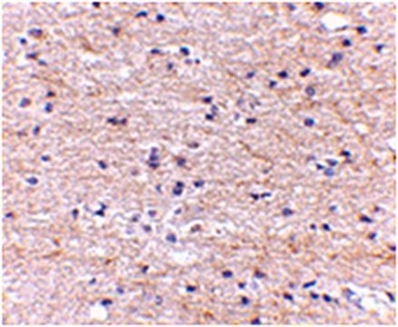 Anti-SATB2 Antibody from rabbit, purified by affinity chromatography