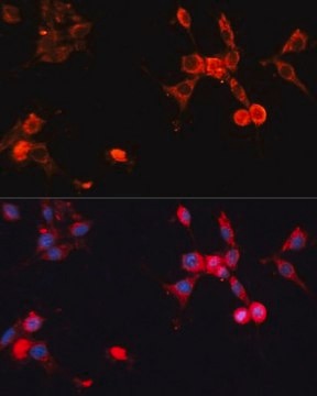 Anti-HSP70 antibody produced in rabbit