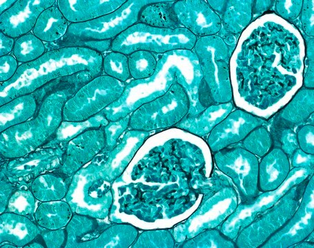 ISOSLIDE&#8482; Methenamine Control Slides control slides with reference tissue for the detection of argent-affine structures in histological tissue