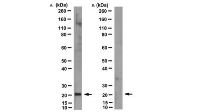 Anti-MT-ATP6 Antibody, clone 1G7-1G2 clone 1G7-1G2, from mouse