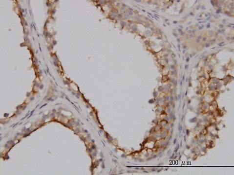 Monoclonal Anti-GGT1 antibody produced in mouse clone 1F9, purified immunoglobulin, buffered aqueous solution