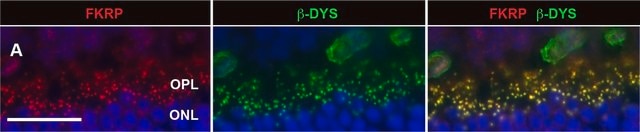 Anti-Collagen Antibody, Type IV Chemicon&#174;, from rabbit