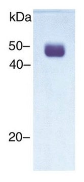 Urokinase-type Plasminogen Activator