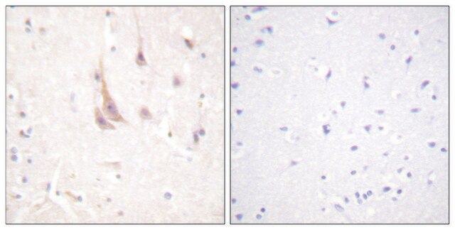 Anti-PKC &#950; antibody produced in rabbit affinity isolated antibody