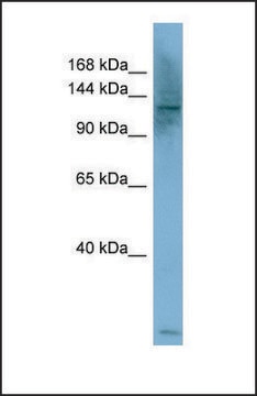 Anti-PLCB1 antibody produced in rabbit affinity isolated antibody