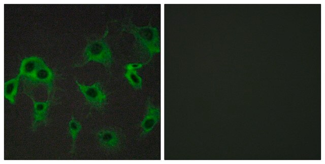 Anti-ADRB2 antibody produced in rabbit affinity isolated antibody