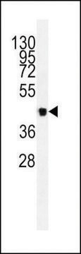 ANTI-VEGFC antibody produced in mouse IgG fraction of antiserum, buffered aqueous solution