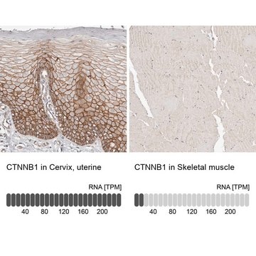 Anti-CTNNB1 antibody produced in rabbit Prestige Antibodies&#174; Powered by Atlas Antibodies, affinity isolated antibody, buffered aqueous glycerol solution