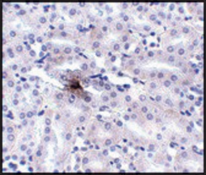 Anti-ZIP11 antibody produced in rabbit affinity isolated antibody, buffered aqueous solution