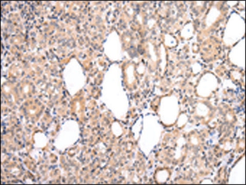 Anti-CDK8 affinity isolated antibody