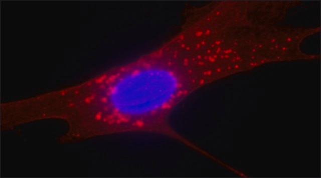 Anti-Fibroblast Surface Protein antibody, Mouse monoclonal clone 1B10, purified from hybridoma cell culture