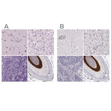 Anti-KRT25 antibody produced in rabbit Prestige Antibodies&#174; Powered by Atlas Antibodies, affinity isolated antibody