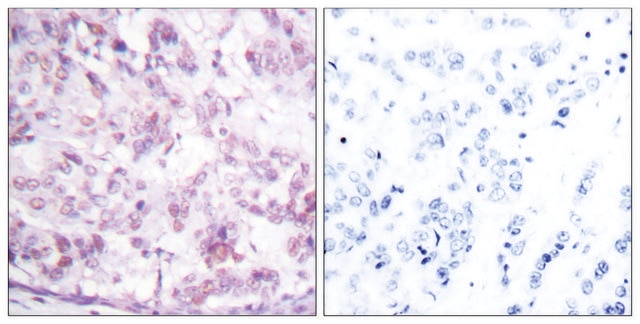 Anti-MYB antibody produced in rabbit affinity isolated antibody