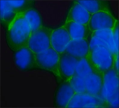 Anti-&#946;-Catenin antibody, Mouse monoclonal clone 15B8, purified from hybridoma cell culture