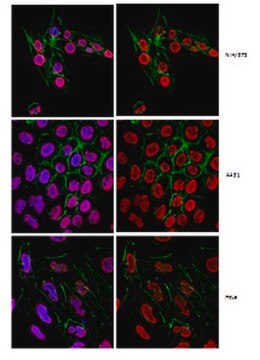 Anti-2,2,7-Trimethylguanosine Antibody, clone K121 clone K121, from mouse