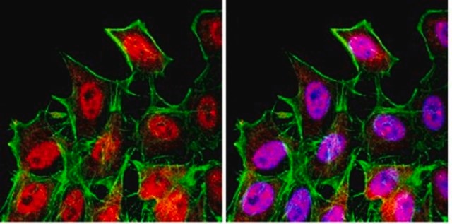 Anti-FOXO3A Antibody from rabbit, purified by affinity chromatography