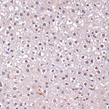 Anti-CDKN2A/p16INK4a antibody produced in rabbit