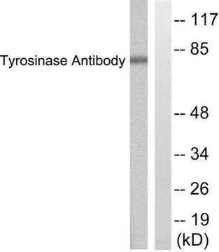 Anti-Tyrosinase antibody produced in rabbit affinity isolated antibody