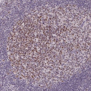 Anti-MLH1 antibody produced in rabbit Prestige Antibodies&#174; Powered by Atlas Antibodies, affinity isolated antibody, buffered aqueous glycerol solution