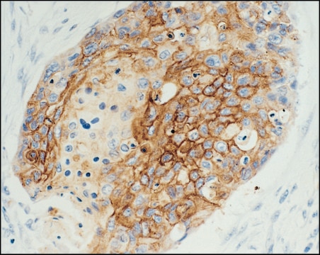 Monoclonal Anti-Epidermal Growth Factor Receptor antibody produced in mouse clone 29.1, ascites fluid