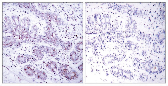 Anti-STAT4 (Ab-693) antibody produced in rabbit affinity isolated antibody