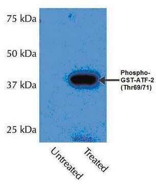 Anti-phospho-p38&#945; (Thr180/Tyr182) Antibody Upstate&#174;, from rabbit