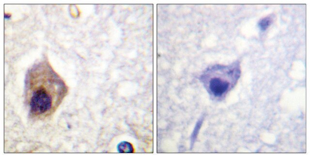 Anti-CASP1, C-Terminal antibody produced in rabbit affinity isolated antibody