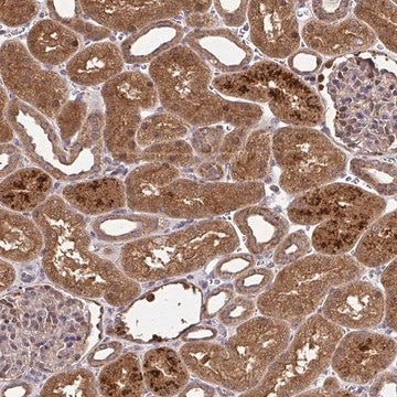 Anti-RDH14 antibody produced in rabbit Prestige Antibodies&#174; Powered by Atlas Antibodies, affinity isolated antibody, buffered aqueous glycerol solution