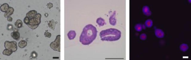 3dGRO&#174; Human CRC Organoids (ISO57)