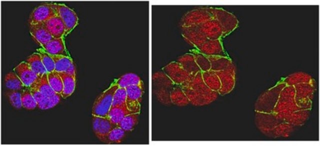 Anti-BRCA1 Antibody, clone MS110 clone MS110, from mouse