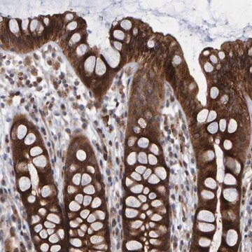 Anti-LRBA antibody produced in rabbit Prestige Antibodies&#174; Powered by Atlas Antibodies, affinity isolated antibody, buffered aqueous glycerol solution, Ab2