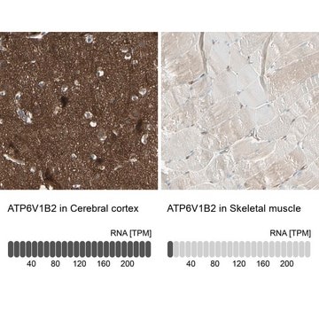 Anti-ATP6V1B2 antibody produced in rabbit Prestige Antibodies&#174; Powered by Atlas Antibodies, affinity isolated antibody, buffered aqueous glycerol solution