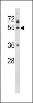 ANTI-FIBG(C-TERMINAL) antibody produced in rabbit purified immunoglobulin, buffered aqueous solution