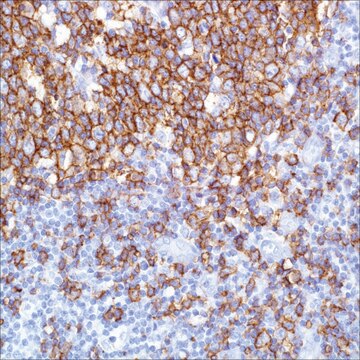 CD20 (SP32) Rabbit Monoclonal Antibody