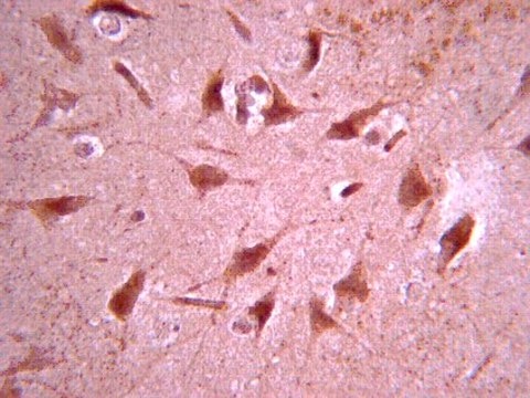 Anti-Dopamine D(1A) Receptor Antibody from rabbit, purified by affinity chromatography