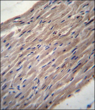 ANTI-PLOD1 (N-TERM) antibody produced in rabbit IgG fraction of antiserum, buffered aqueous solution