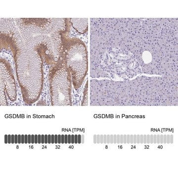 Anti-GSDMB antibody produced in rabbit Prestige Antibodies&#174; Powered by Atlas Antibodies, affinity isolated antibody, buffered aqueous glycerol solution