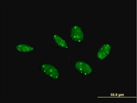 Anti-COIL antibody produced in mouse purified immunoglobulin, buffered aqueous solution