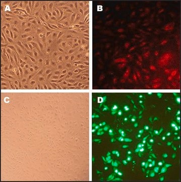 Human Coronary Artery Endothelial Cells: HCAEC, adult