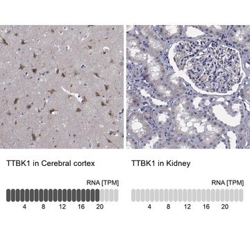 Anti-TTBK1 antibody produced in rabbit Prestige Antibodies&#174; Powered by Atlas Antibodies, affinity isolated antibody, buffered aqueous glycerol solution