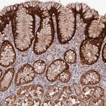 Anti-DDX60 antibody produced in rabbit Prestige Antibodies&#174; Powered by Atlas Antibodies, affinity isolated antibody, buffered aqueous glycerol solution