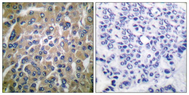 Anti-HCG &#946; antibody produced in rabbit affinity isolated antibody