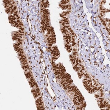 Anti-HNRNPA1 antibody produced in rabbit Prestige Antibodies&#174; Powered by Atlas Antibodies, affinity isolated antibody, buffered aqueous glycerol solution